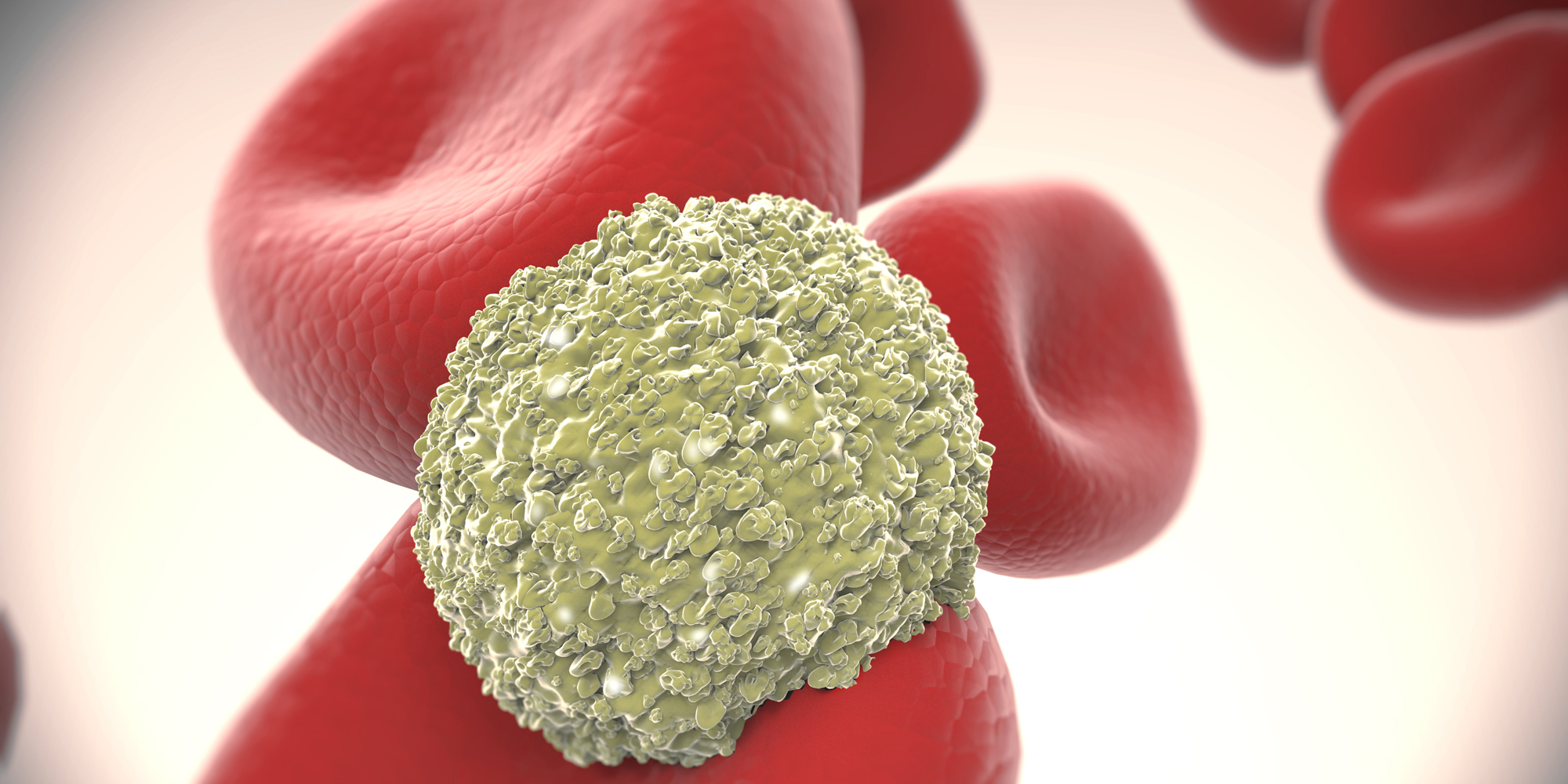 Aspirin Disrupts Cholesterol Rafts in Lipid Membranes Canadian